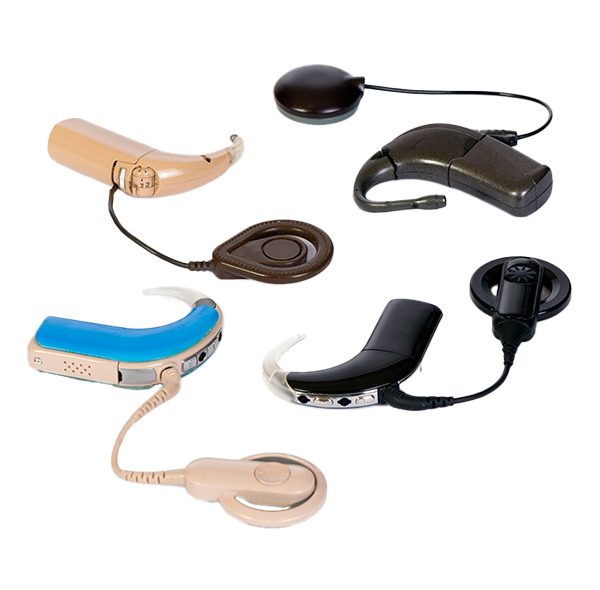 Cochlear Implant examples